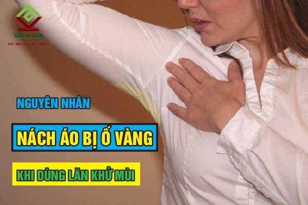 Các loại lăn khử mùi không làm vàng áo tốt nhất