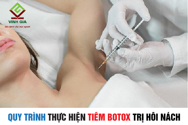 Quy trình thực hiện tiêm Botox trị hôi nách
