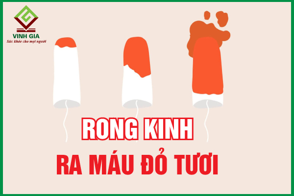 Bị rong kinh ra máu đỏ tươi có sao không?