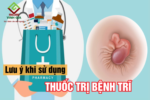 Những điều cần lưu ý khi chữa bệnh trĩ bằng thuốc Những điều cần lưu ý khi chữa bệnh trĩ bằng thuốc