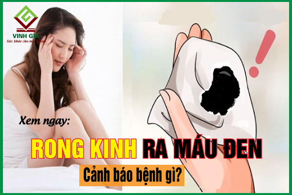 Rong kinh ra máu đen liệu có nguy hiểm? Cần phải làm gì?