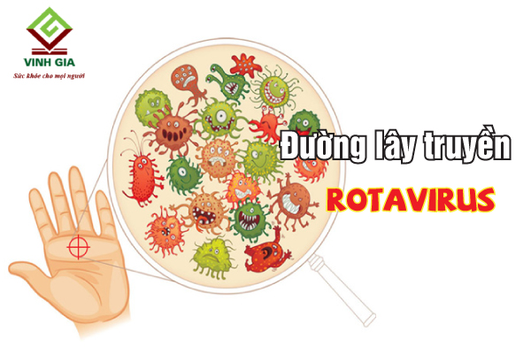 Bệnh tiêu chảy do rotavirus rất dễ truyễn nhiễm và bùng thành dịch