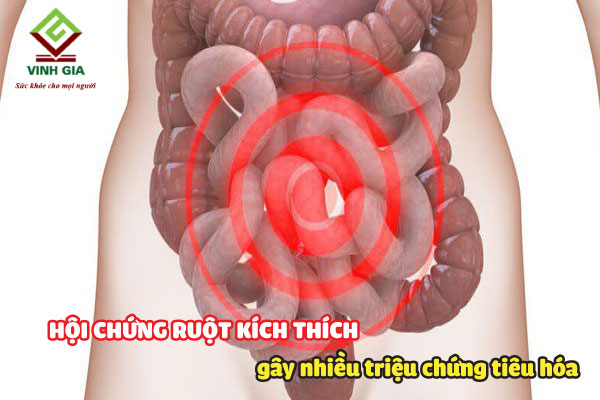 Hội chứng ruột kích thích gây nhiều triệu chứng tiêu hóa trong đó gây táo bón đau lưng đau bụng dưới