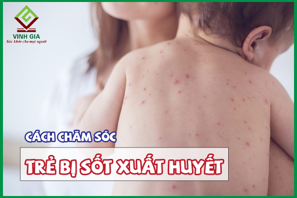 Hướng dẫn cách chăm sóc trẻ bị sốt xuất huyết