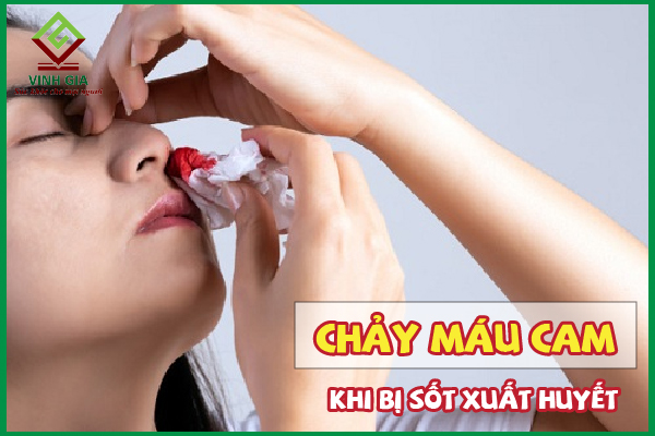 Chảy máu cam khi bị sốt xuất huyết có nguy hiểm không?