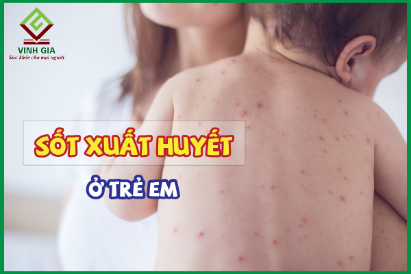 Những dấu hiệu cảnh báo sốt xuất huyết ở trẻ em