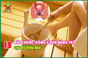 13 bài thuốc xông chữa bệnh trĩ cực kỳ hiệu quả