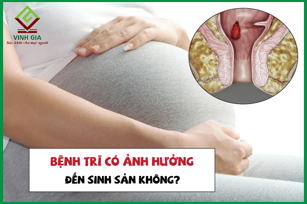 Bệnh trĩ có ảnh hưởng đến sinh sản ở phụ nữ không?
