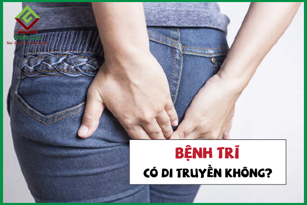 Giải đáp câu hỏi: Bệnh trĩ có di truyền không?