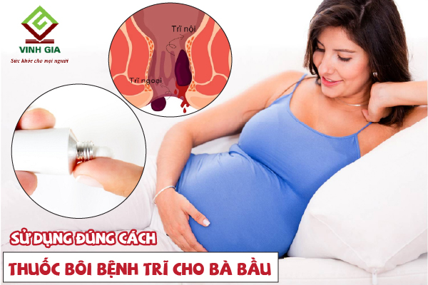 Cách sử dụng thuốc bôi bệnh trĩ cho bà bầu Cách sử dụng thuốc bôi bệnh trĩ cho bà bầu