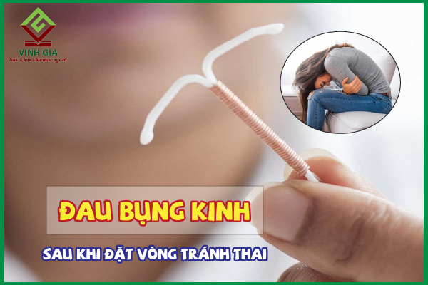 Vì sao chị em bị đau bụng kinh sau khi đặt vòng?