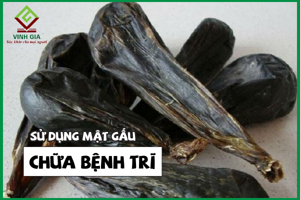 Hướng dẫn cách dùng mật gấu làm dịu cơn đau trĩ hiệu quả