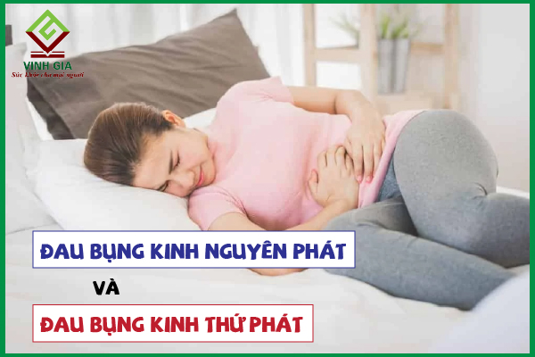 Phân biệt đau bụng kinh nguyên phát và thứ phát