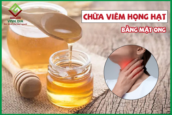 cách chữa viêm họng hạt có mủ
