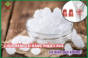 Chữa bệnh trĩ bằng phèn chua liệu có an toàn, hiệu quả?