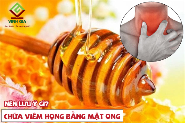 Chữa viêm họng bằng mật ong cần lưu ý điều gì?