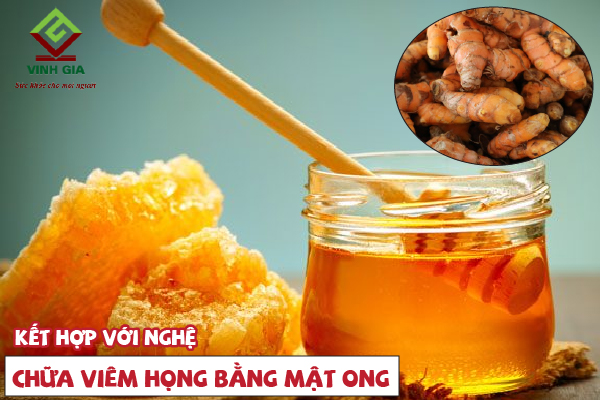 Chữa viêm họng bằng mật ong và nghệ