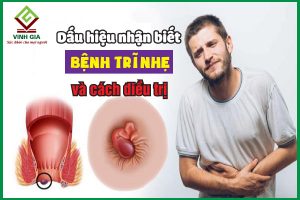 Dấu hiệu nhận biết bệnh trĩ nhẹ và cách chữa trị hiệu quả