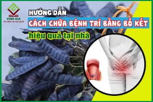 Hướng dẫn cách chữa bệnh trĩ bằng bồ kết tại nhà hiệu quả