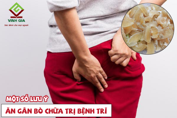 Ngoài gân bò ra thì người bệnh trĩ hãy lưu ý hơn đến chế độ ăn uống của bản thân