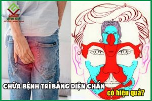 Quy trình áp dụng diện chẩn chữa bệnh trĩ và những lưu ý