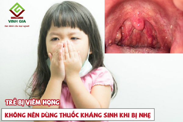 Trẻ bị viêm họng không nên dùng thuốc kháng sinh khi bị nhẹ