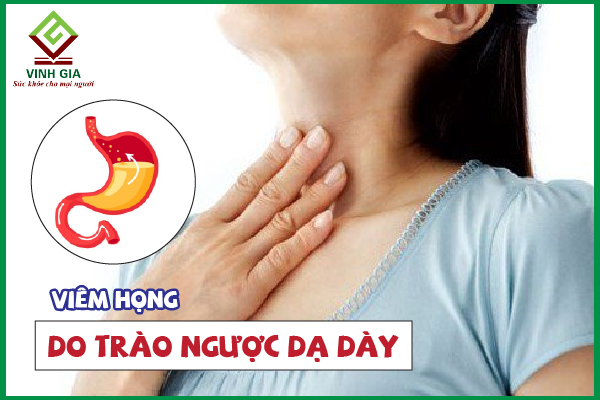 Nên làm gì khi bị viêm họng do trào ngược dạ dày?