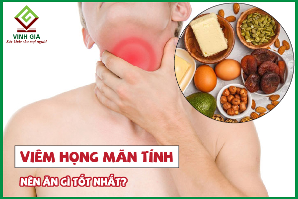 Viêm họng mãn tính nên ăn gì và kiêng gì để chóng phục hồi?
