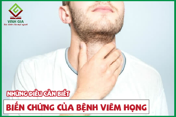 Cẩn thận với các biến chứng nguy hiểm của viêm họng