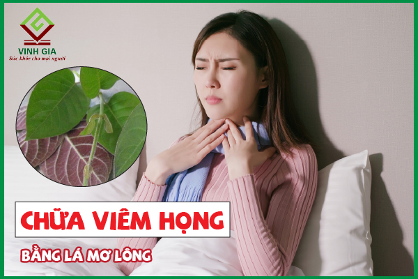 Chữa viêm họng bằng lá mơ lông đúng cách như thế nào?