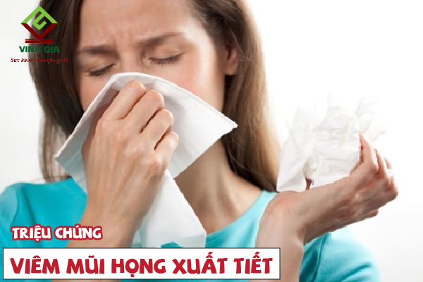 Có những dấu hiệu nào để nhận biết một người bị viêm mũi họng xuất tiết?