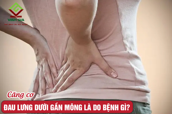 Đau lưng bên dưới gần mông có thể là do căng cơ