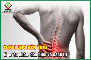 Đau lưng bên trái: Triệu chứng, nguyên nhân và cách điều trị