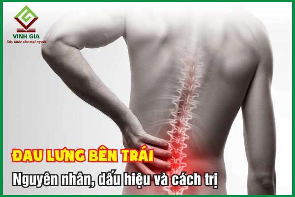 Đau lưng bên trái: Triệu chứng, nguyên nhân và cách điều trị