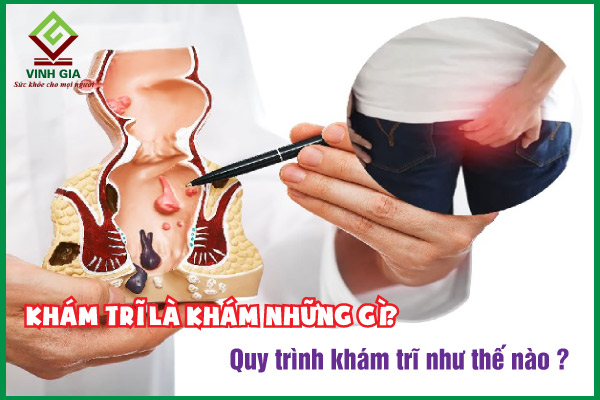 Khám bệnh trĩ như thế nào? Quy trình khám trĩ bao gồm những gì?