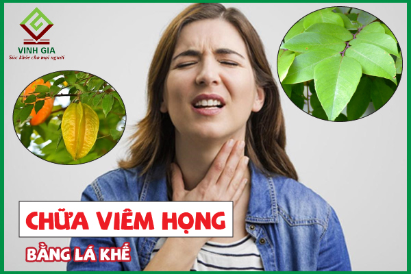 Lá khế chữa viêm họng – mẹo dân gian không phải ai cũng biết
