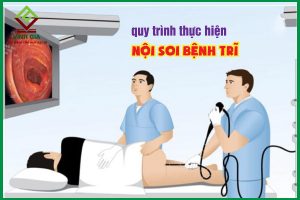 Nội soi bệnh trĩ quy trình thực hiện như thế nào? Có đau không?