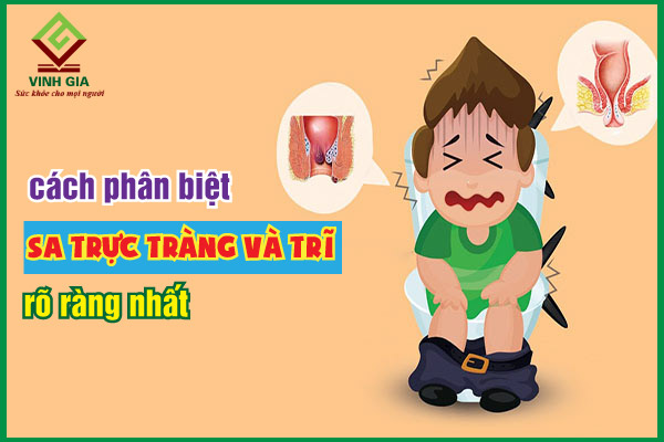 Phân biệt sa trực tràng và trĩ, cách phòng ngừa hai bệnh này