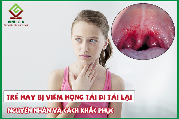 Trẻ hay bị viêm họng tái đi tái lại nhiều lần do đâu?