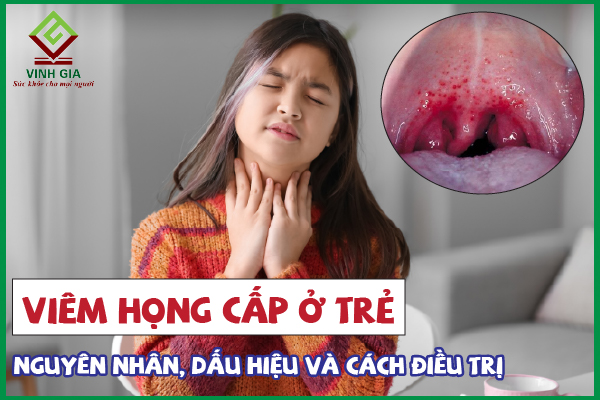 Viêm họng cấp ở trẻ em: Điều trị và phòng ngừa thế nào?