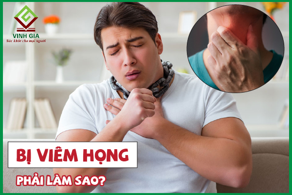 19 Cách trị viêm họng tại nhà siêu đơn giản lại hiệu quả