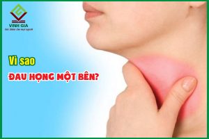 nguyên nhân phổ biến gây đau họng 1 bên và cách điều trị