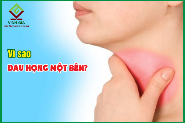 13 nguyên nhân phổ biến gây đau họng 1 bên và cách điều trị