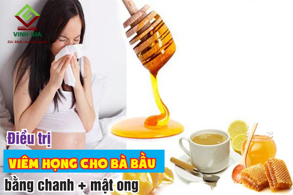 Sử dụng chanh và mật ong là cách trị đau họng cho bà bầu rất an toàn và hiệu quả Sử dụng chanh và mật ong là cách trị đau họng cho bà bầu rất an toàn và hiệu quả