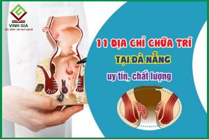 TOP 11 địa chỉ chữa bệnh trĩ tại Đà Nẵng tốt nhất