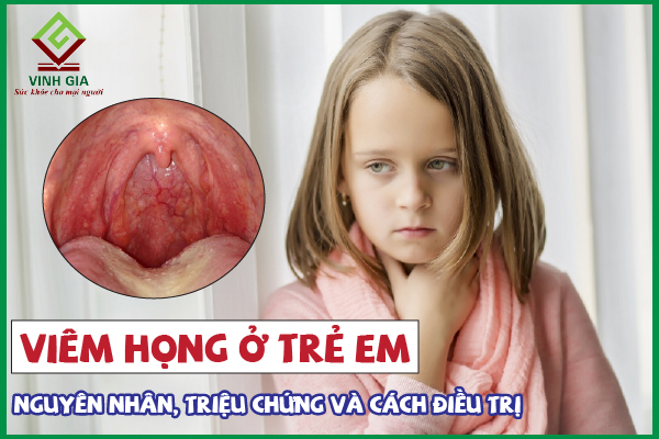 Viêm họng ở trẻ em: Nguyên nhân, dấu hiệu và cách điều trị