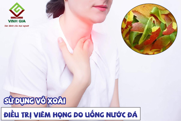 Vỏ xoài có tác dụng chữa viêm họng sau khi uống nước đá