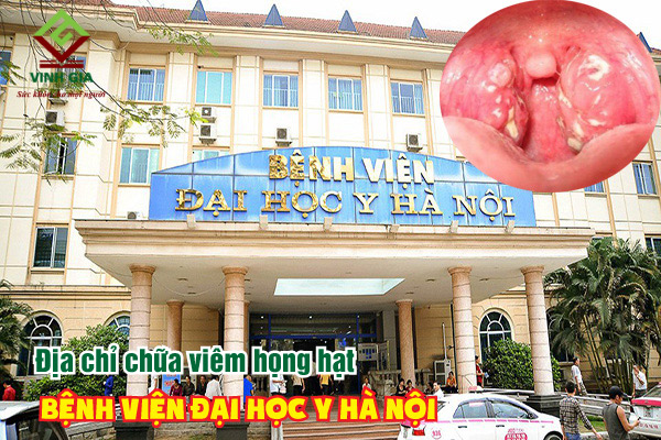 Bệnh viện Đại học Y Hà Nội địa chỉ khám và điều trị bệnh viêm họng hạt được nhiều người tin tưởng