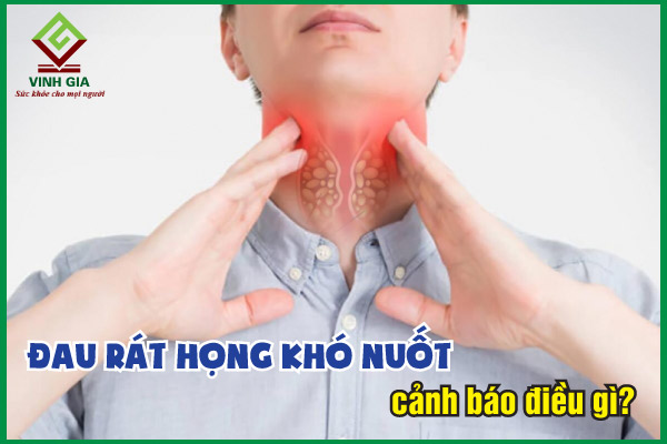 Đau rát họng khó nuốt cảnh báo điều gì?