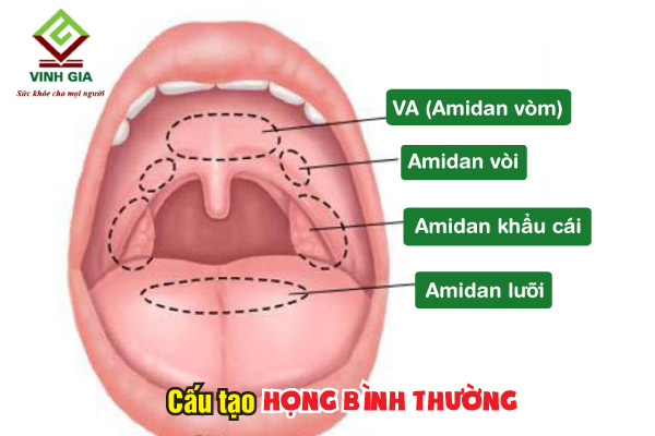 Hình hình họa viêm họng cụ thể nhất và họng bình thường